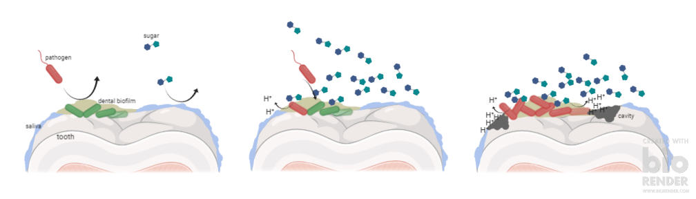 Bacteria cause caries by producing an acidic environment.
