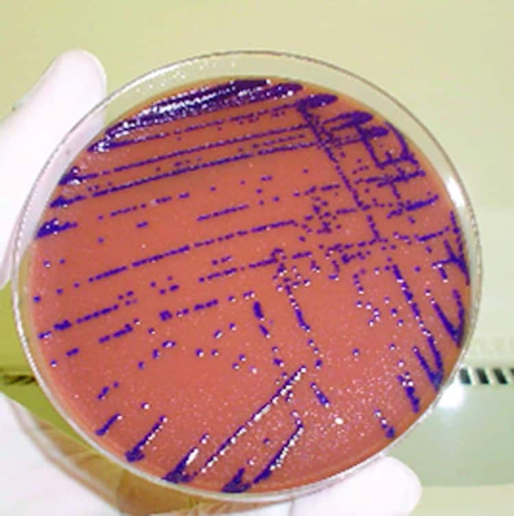 Chromobacterium violaceum colonies turn purple
