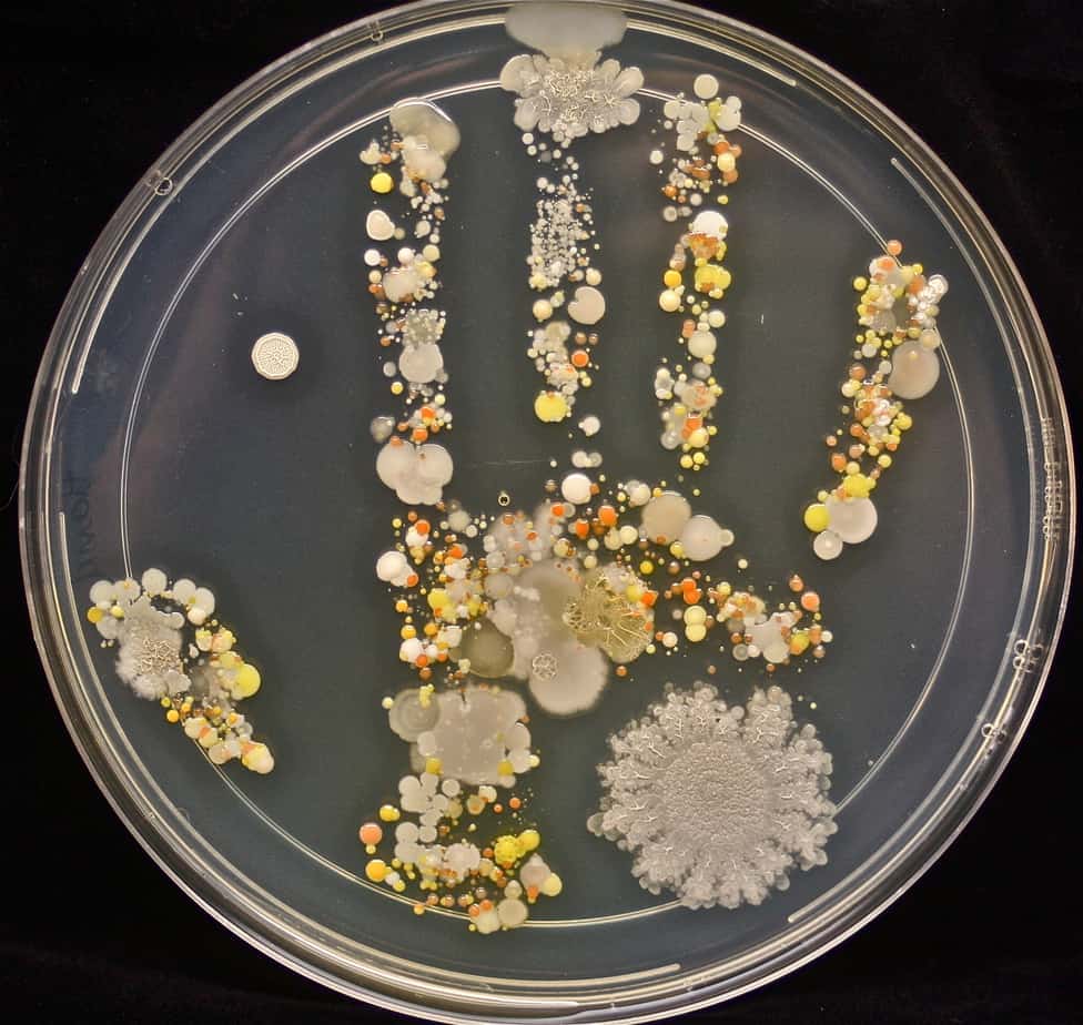 Microbial profile of the skin microbiome of a hand.