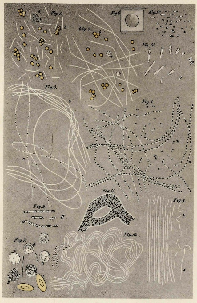 Koch’s drawings of Bacillus anthracis during different stages of sporulation. Ferdinand Cohn and Robert Koch first discovered the formation and germination of endospores of Bacillus in the late 1870s.